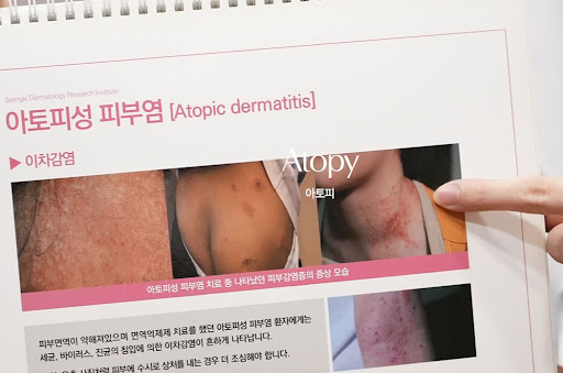 생기한의원으로 알아보는 아토피 원인이 복합적인 이유